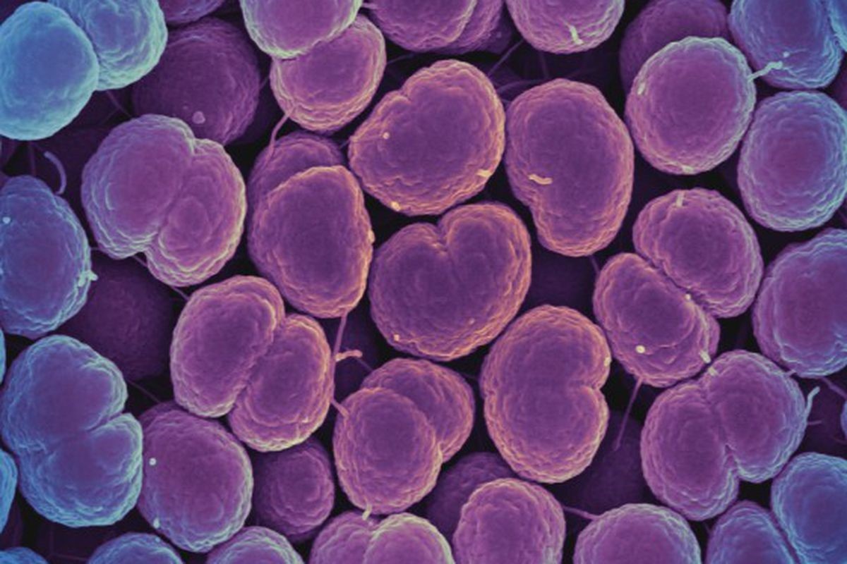 Bệnh lậu không chữa được lan tràn ở Trung Quốc - 1
Lậu cầu Neisseria gonorrhoeae, thủ phạm gây ra bệnh lậu. Ảnh: NIAID / Flickr.