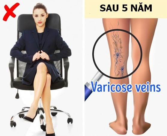 Chuyên gia cảnh báo những tác hại khôn lường của thói quen ngồi nhiều, lười vận động - 3 Chuyên gia cảnh báo những tác hại khôn lường của thói quen ngồi nhiều, lười vận động - 3