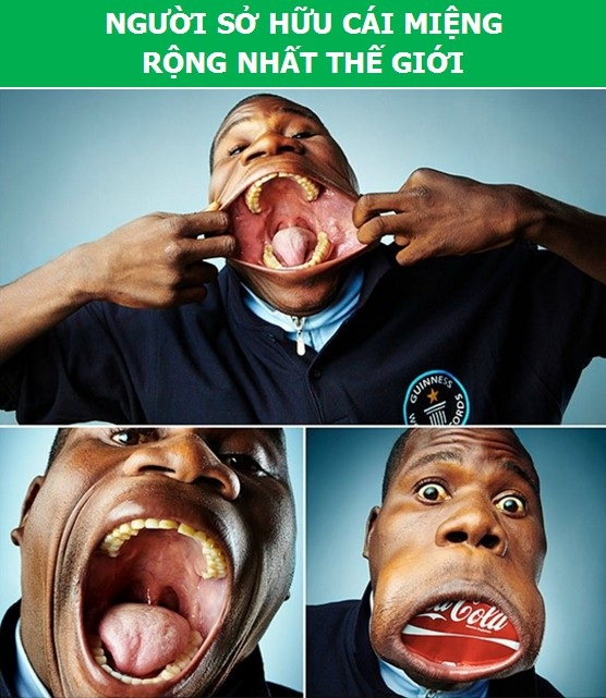 Sửng sốt với những người có cơ thể “dị” nhất thế giới - 2 Sửng sốt với những người có cơ thể “dị” nhất thế giới - 2
