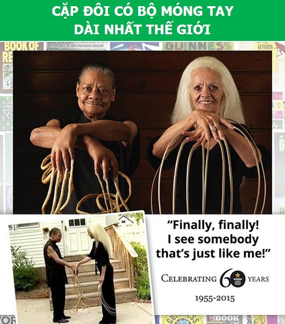 Sửng sốt với những người có cơ thể “dị” nhất thế giới - 4 Sửng sốt với những người có cơ thể “dị” nhất thế giới - 4