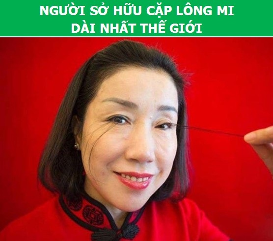 Sửng sốt với những người có cơ thể “dị” nhất thế giới - 6 Sửng sốt với những người có cơ thể “dị” nhất thế giới - 6