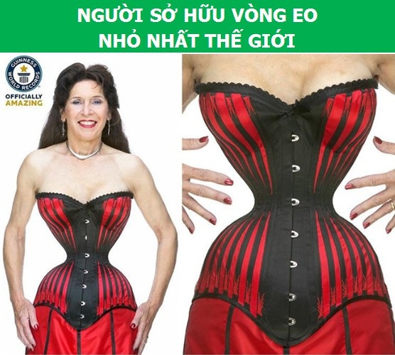 Sửng sốt với những người có cơ thể “dị” nhất thế giới - 7 Sửng sốt với những người có cơ thể “dị” nhất thế giới - 7