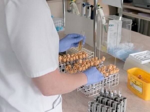 Phát hiện mới trong điều trị ung thư liên quan đến protein ERK5 - 1
Ảnh minh họa. (Nguồn: quotidianodiragusa.it)