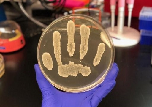 Vi khuẩn có lợi trên da phòng chống ung thư da - 1 Vi khuẩn có lợi trên da phòng chống ung thư da - 1