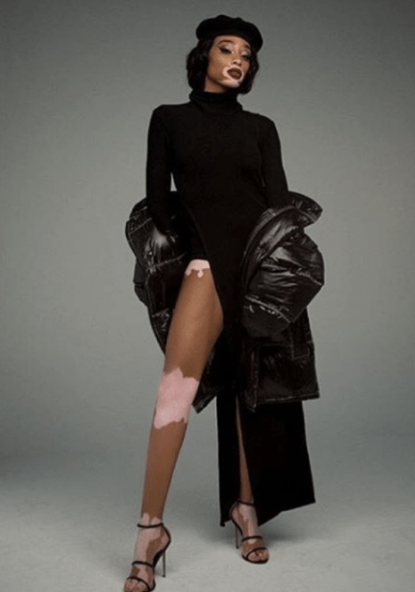 Winnie Harlow quyến rũ với váy xuyên thấu - 8 
Winnie Harlow đã khẳng định một chân lý rằng, ai cũng có thể đẹp theo cách của mình. Hãy yêu thương bản thân và trân trọng chính mình.
