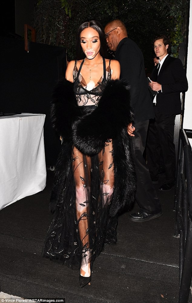 Winnie Harlow quyến rũ với váy xuyên thấu - 3 
Winnie Harlow, 23 tuổi, cao 1,75m là trường hợp đặc biệt trong làng người mẫu khi sở hữu làn da loang màu do bị bệnh bạch biến nhưng vẫn nổi tiếng