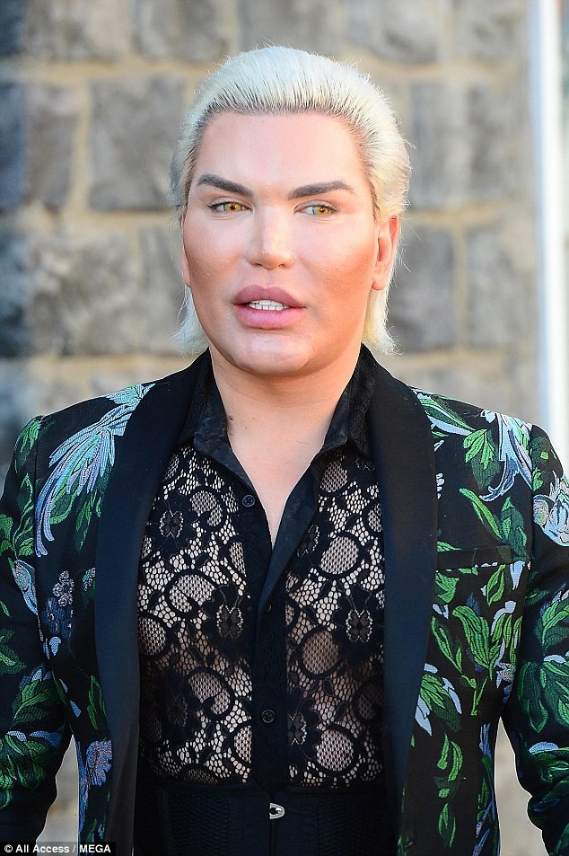 “Búp bê Ken” Rodrigo Alves và bạn gái cùng phẫu thuật cắt bỏ xương sườn - 3
Rodrigo Alves đã cắt bỏ xương sườn rồi đeo eo định hình để có vòng hai nhỏ hết mức.