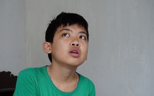 Thương cậu bé không cha đối mặt với nguy cơ biến mất cả hàm răng - 1 Trần Đình Quý mắc bệnh u nang rễ răng, đã trải qua 3 lần phẫu thuật bóc tách nang, nhổ 5 chiếc răng