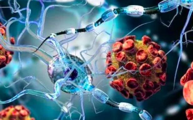 Điều trị tế bào gốc mang lại hy vọng mới cho bệnh nhân đa xơ cứng - 1 Thử nghiệm quốc tế cũng cho thấy điều trị ghép tế bào gốc có thể làm giảm tàn phế cho những người bị MS.