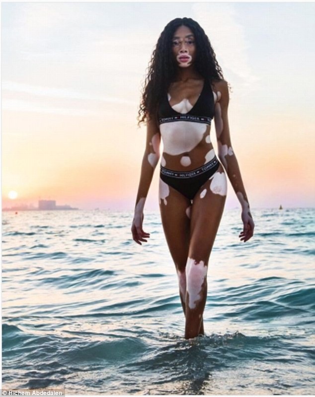 
Winnie Harlow khoe dáng gợi cảm trên bãi biển Dubai ngày 25/3 vừa qua
