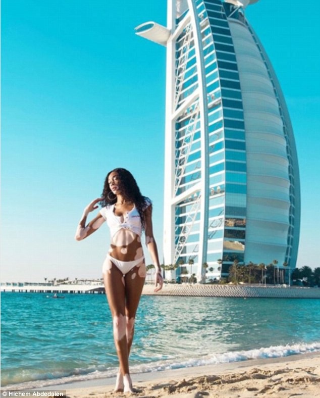 
Chân dài người Canada nổi tiếng sau khi tham gia cuộc thi Americas Next Top Model năm 2014
