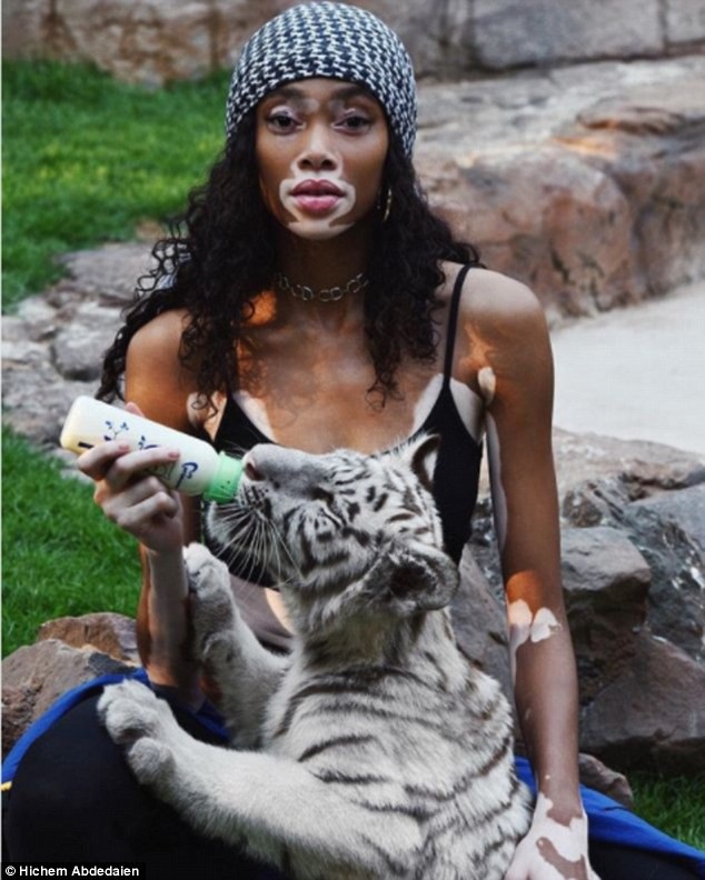 
Tuy nhiên Winnie Harlow vẫn rất nỗ lực vươn lên và không từ bỏ ước mơ
