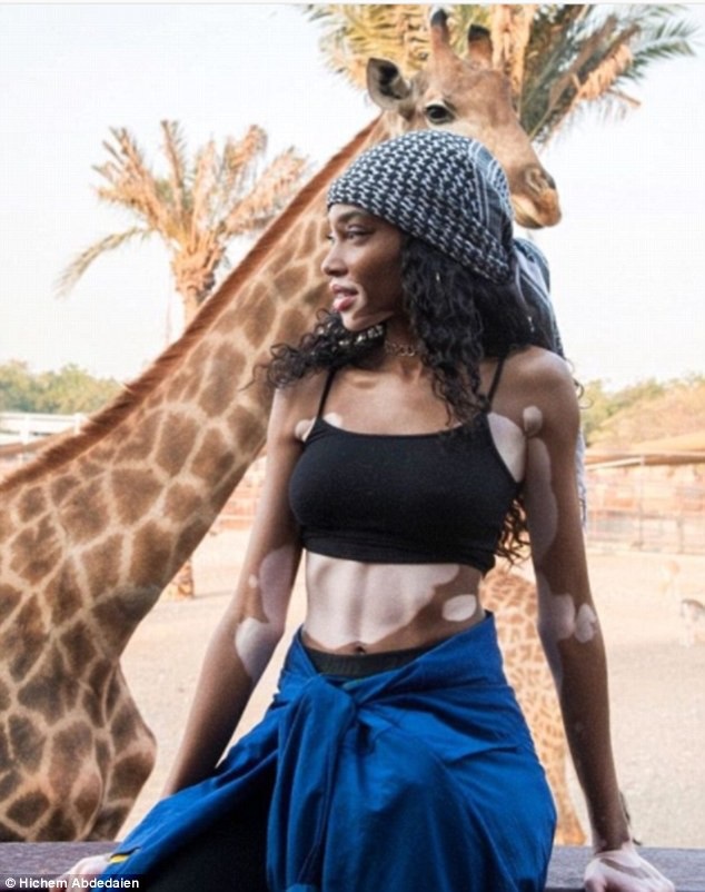 
Giờ đây Winnie Harlow đã trở thành biểu tượng mới của làng thời trang
