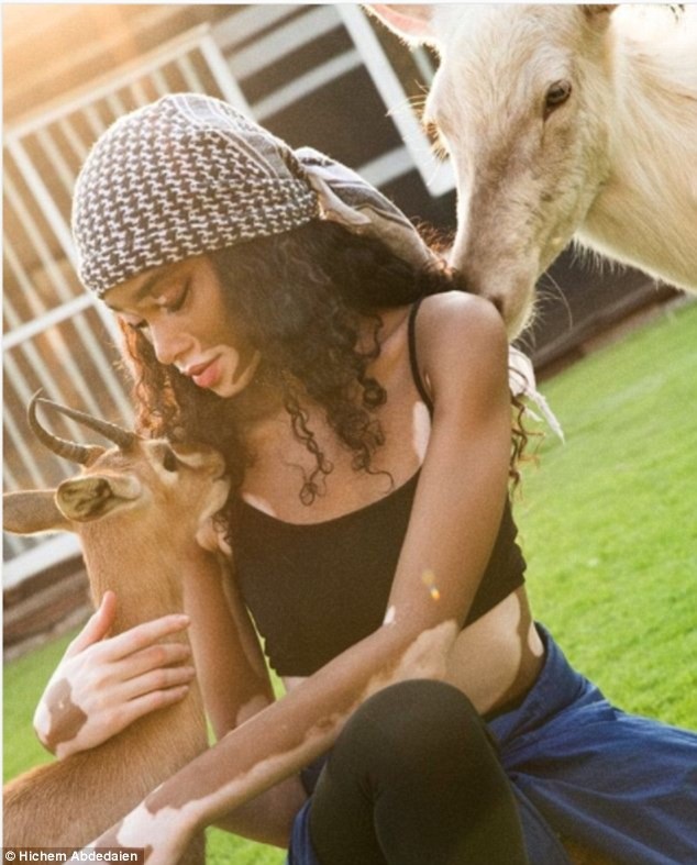 
Năm 2015, Winnie Harlow được tạp chí GQ trao danh hiệu người mẫu của năm.
