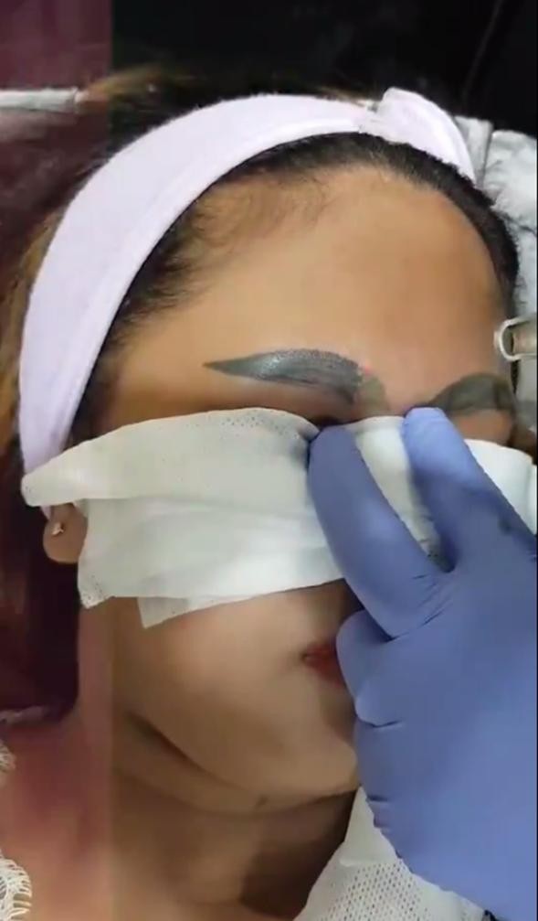 Nhan sắc gây cười của cô gái xăm lông mày hỏng - 5 Dự kiến lông mày của cô gái sẽ mờ dần trong vòng 3 tháng đến nửa năm