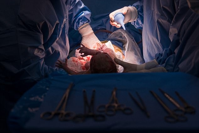 Trẻ sinh mổ dễ bị tiểu đường hoặc béo phì khi lớn lên - 1 Trẻ sinh mổ có nguy cơ bị bệnh đái tháo đường hoặc béo phì gấp 2,5 lần