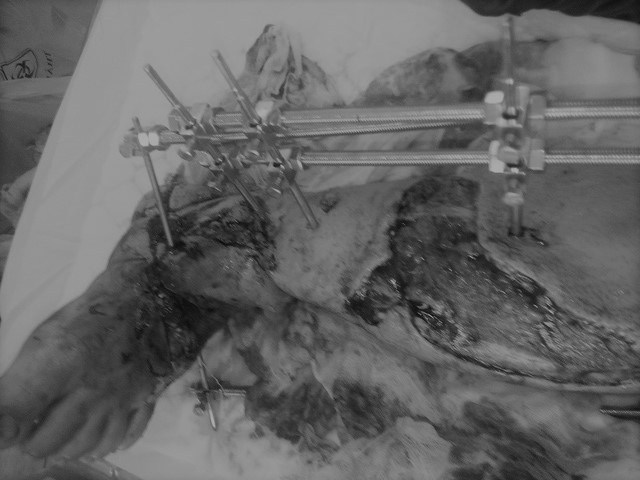 
Tai nạn trong lúc làm việc là hiểm họa luôn rình rập người lao động.
