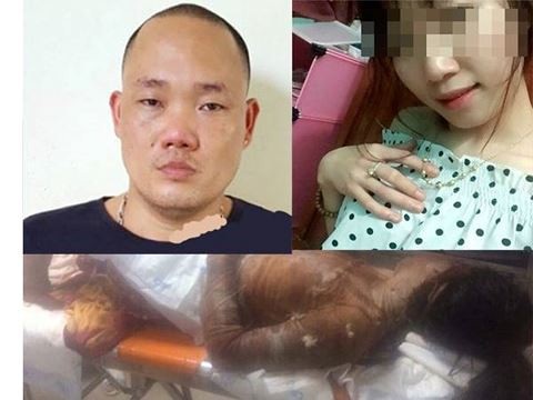 Bắt nghi can tẩm xăng phóng hỏa 2 cô gái bị bỏng nặng - 1 Đối tượng Định và nạn nhân trước và sau khi bị người yêu tẩm xăng thiêu sống
