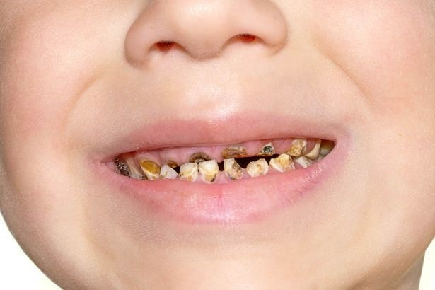 
Hành động thơm môi trẻ có thể dẫn đến hậu quả này.
