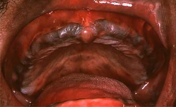 Tác hại không ngờ khi dùng son môi không rõ nguồn gốc - 3 Tác hại không ngờ khi dùng son môi không rõ nguồn gốc - 3