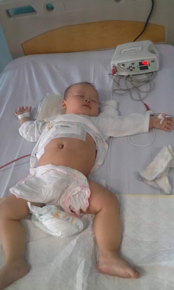 Xót xa bé 10 tháng bị u nguyên bào gan - 4 Hình ảnh cậu bé nằm điều trị tại bệnh viện Nhi TW.