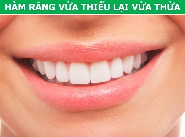 Giới khoa học “bóc mẽ” những điểm bất cập trong cấu tạo cơ thể người - 2 Giới khoa học “bóc mẽ” những điểm bất cập trong cấu tạo cơ thể người - 2