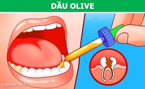 Những phương pháp cực đơn giản giúp làm dịu cơn đau răng tức thì - 3 Những phương pháp cực đơn giản giúp làm dịu cơn đau răng tức thì - 3