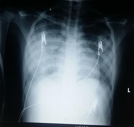 X-Quang kiểm tra bệnh hiếm gặp của bệnh nhi