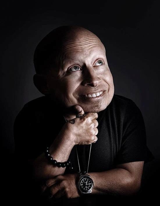 Sao phim Harry Potter qua đời ở tuổi 49 - 4
Verne Troyer được cho là qua đời sau một thời gian dài vật lộn với bệnh trầm cảm và chứng nghiện rượu