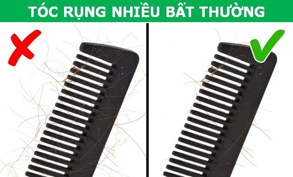 Những dấu hiệu cho thấy bạn đang bị "già đi nhanh hơn bình thường" - 4 Những dấu hiệu cho thấy bạn đang bị "già đi nhanh hơn bình thường" - 4