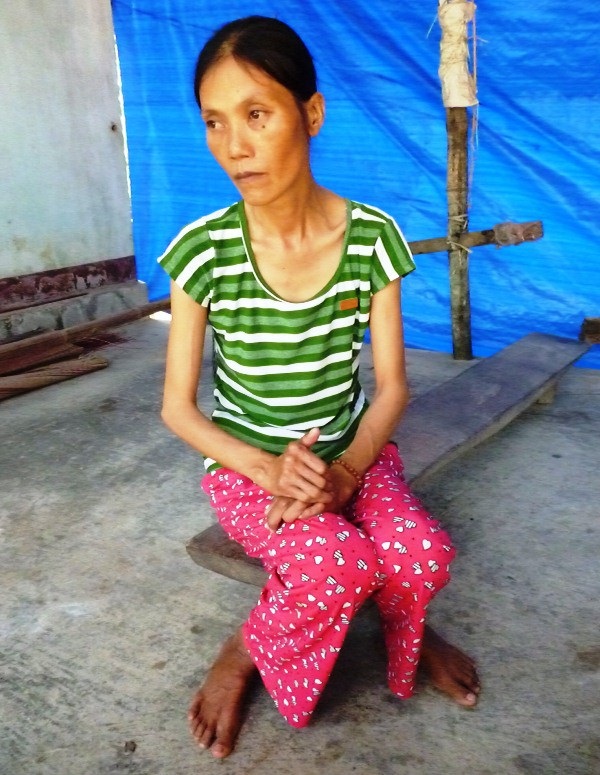Không tiền mổ tim, người phụ nữ nghèo về nhà chờ… chết - 4 Chị Căn tiều tùy, da bọc xương vì bệnh tim nặng.