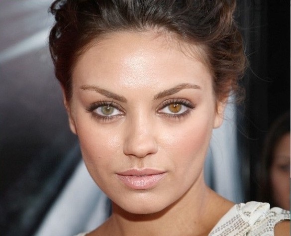 Dù vậy, đôi khi, hiện tượng “hai mắt, hai màu” xuất hiện ở người trưởng thành là do những chứng bệnh về mắt. Nữ diễn viên Hollywood - Mila Kunis (34 tuổi)- từng tiết lộ rằng cô đã phải âm thầm điều trị chứng bệnh về mắt trong nhiều năm và hiện một bên mắt đã gần như mất thị lực, chứng bệnh này đã khiến một bên mắt của cô đổi màu. Để không tạo nên sự khác biệt bất thường về diện mạo, khi tham gia đóng phim, Mila Kunis thường đeo kính áp tròng để cả hai mắt cùng màu.