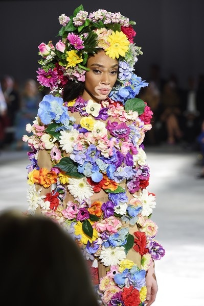 Người mẫu bạch biến hở bạo bên Bella Hadid - 16
Winnie Harlow tham gia trình diễn trong show thời trang vì mục đích từ thiện này