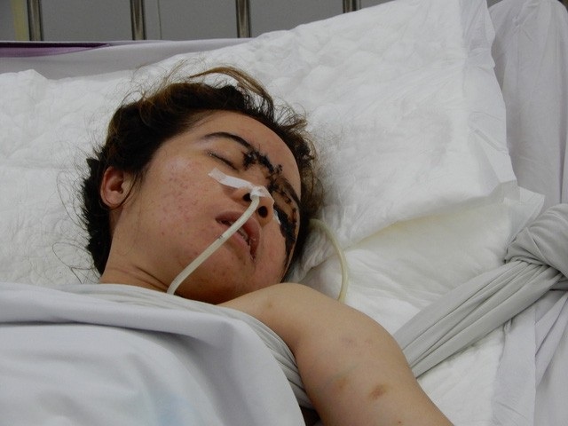 Đà Nẵng: Trao 32 triệu đồng đến cô gái trẻ đang nguy kịch vì tai nạn giao thông - 2 Bệnh nhân Võ Thị Mỹ Ngân đang nằm viện điều trị do đa chấn thương sau tai nạn giao thông