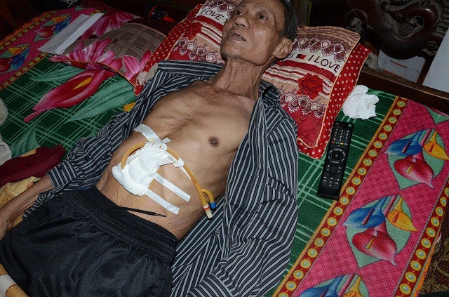Anh Nguyễn Trung Quàng đã mãi mãi ra đi - 1 Anh Quàng đã ra đi sau một thời gian chiến đấu với căn bệnh ung thư thực quản