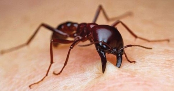 Những cách chữa bệnh lạ của con người thời kỳ đồ đá - 3
Sử dụng kiến để khâu vết thương của bác sĩ Thời kỳ Đồ đá mới.