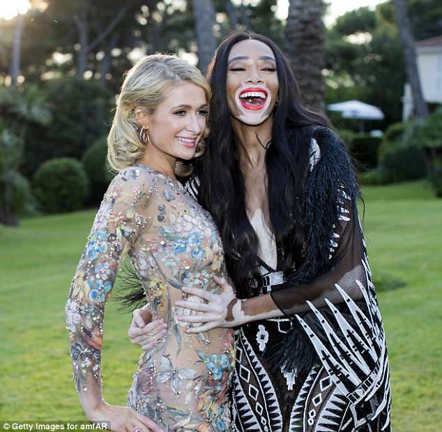 Siêu mẫu bị bạch biến khoe dáng gợi cảm - 4
Người đẹp 9X vui vẻ bên đàn chị Paris Hilton