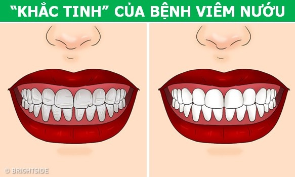 Điều kỳ diệu gì sẽ xảy ra nếu bạn ăn cần tây đều đặn trong một tuần? - 4 Điều kỳ diệu gì sẽ xảy ra nếu bạn ăn cần tây đều đặn trong một tuần? - 4