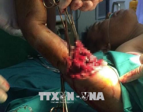 
Các bác sỹ Trung tâm Y tế Bạch Long Vĩ tiến hành phẫu thuật cho nạn nhân. Ảnh: Phạm Hải
