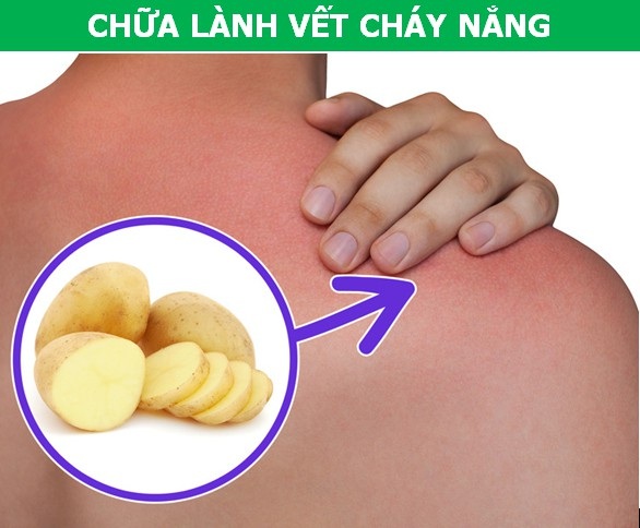 Bất ngờ với vô vàn công dụng đời sống ít biết của củ khoai tây - 2 Bất ngờ với vô vàn công dụng đời sống ít biết của củ khoai tây - 2