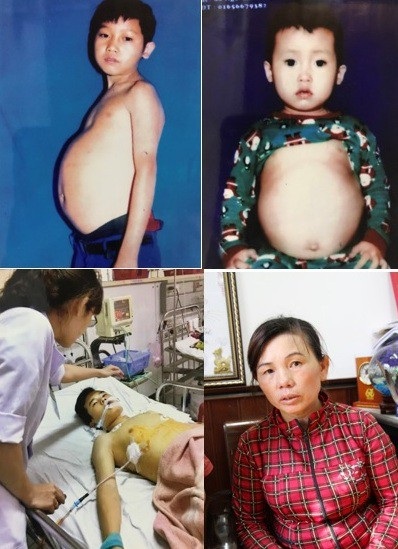 Chồng ngược đãi, vợ một mình gồng gánh chữa bệnh cho 3 con bệnh tật, tai nạn - 5 4 mẹ con chị Quy đang chống chọi với chuỗi ngày khó khăn trước mắt và rất cần sự giúp đỡ của quý nhà hảo tâm