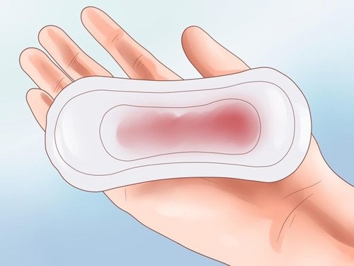 Sưng đau chân – Biểu hiệu không ngờ của ung thư cổ tử cung - 2 Chảy máu âm đạo bất thường là dấu hiệu thường gặp nhất của ung thư cổ tử cung