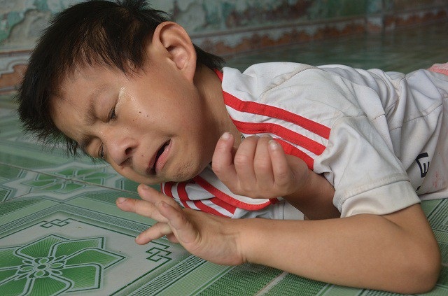 Gia cảnh khốn cùng của bé 9 tuổi, mắc đa dị tật bẩm sinh - 6 Hằng ngày em bị các cơn động kinh liên tiếp hành hạ, có ngày lên đến bảy, tám lần