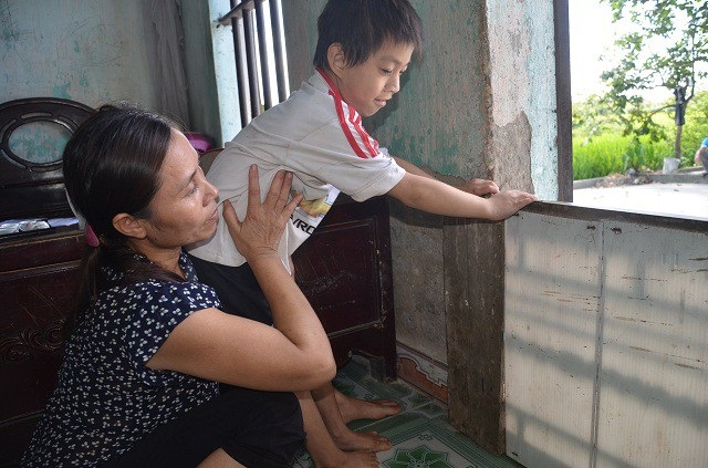 Gia cảnh khốn cùng của bé 9 tuổi, mắc đa dị tật bẩm sinh - 7 Gia cảnh khốn cùng của bé 9 tuổi, mắc đa dị tật bẩm sinh - 7