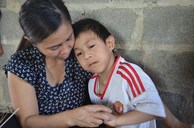 Gia cảnh khốn cùng của bé 9 tuổi, mắc đa dị tật bẩm sinh - 9 Gia cảnh khốn cùng của bé 9 tuổi, mắc đa dị tật bẩm sinh - 9