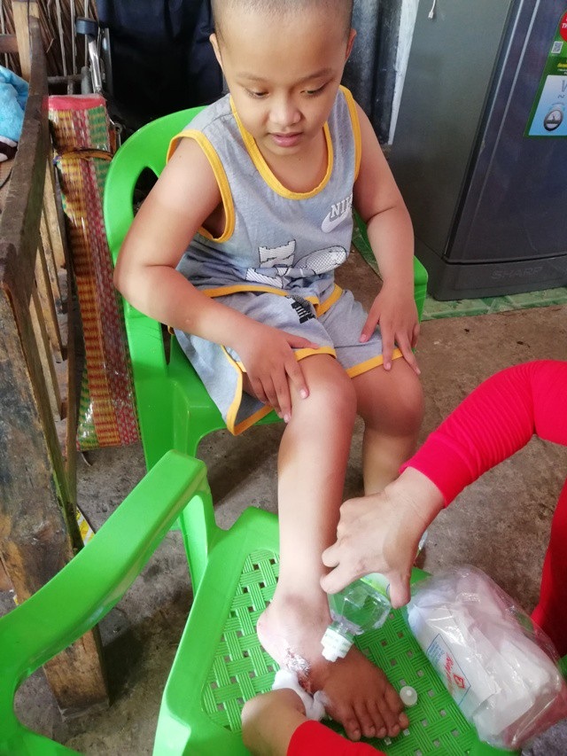 Mồ côi cha mẹ, bé 15 tuổi mắc bệnh tim khốn khó chăm em mắc bệnh bại não - 4 Một lần cháu Nguyên đi thăm cha còn nằm ở bệnh viện, chẳng may bị bỏng đến giờ vết thương còn đau rát...