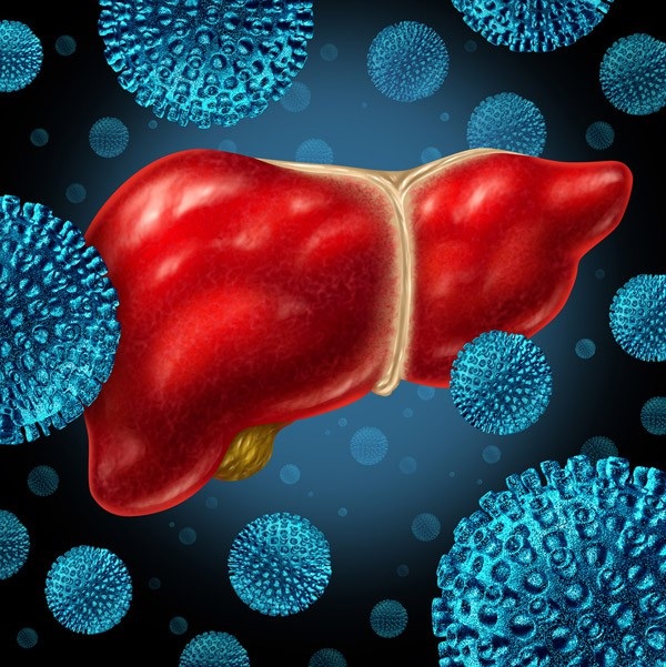 Phát hiện sớm viêm gan B làm giảm 1 nửa nguy cơ ung thư gan - 2 Nhiễm virus viêm gan B, C mạn tính làm tăng nguy cơ ung thư gan gấp 200 lần so với người không nhiễm bệnh.