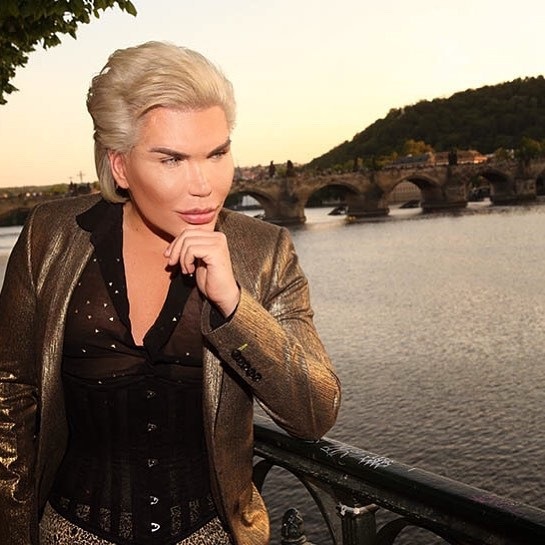 "Búp bê Ken" Rodrigo Alves sang Séc "tân trang nhan sắc" - 5
Rodrigo Alves tin rằng vẻ đẹp hoàn hảo của anh đã thu hút sự chú ý của cả nam và nữ