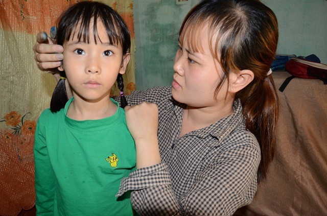 Ánh mắt đáng thương của bé 7 tuổi bị thiểu năng trí tuệ - 6
Liệu bé Hảo có cơ hội phát triển như những đứa trẻ bình thường khác nếu em được chữa trị đều đặn ?