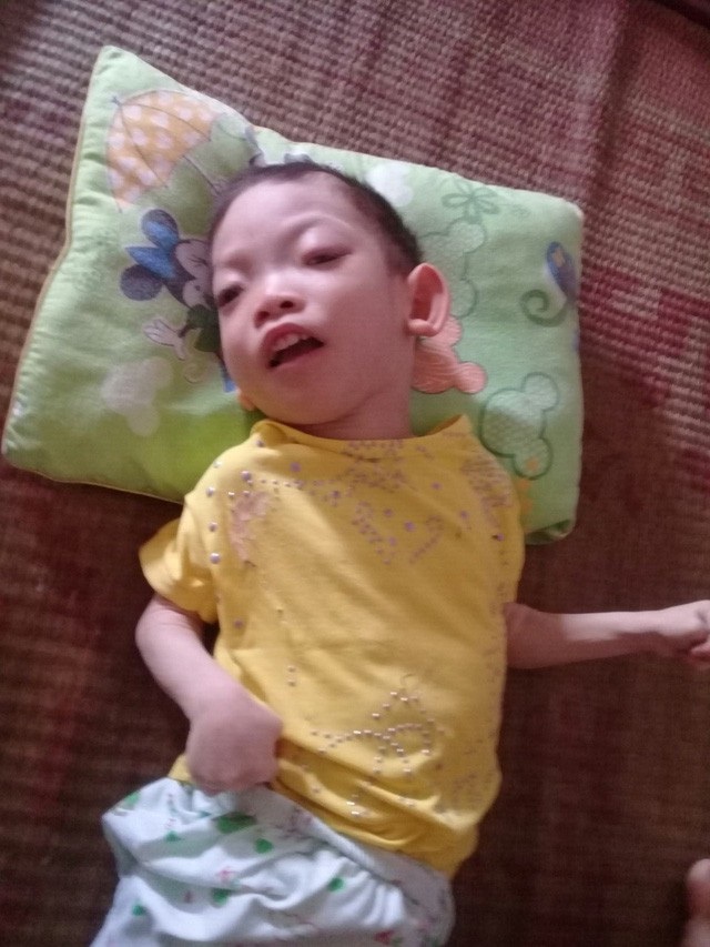 Hơn 195 triệu đồng đến với người mẹ có 2 con bệnh não - 2 Con gái đầu là bé Phương Vy (6 tuổi) bị bại não.